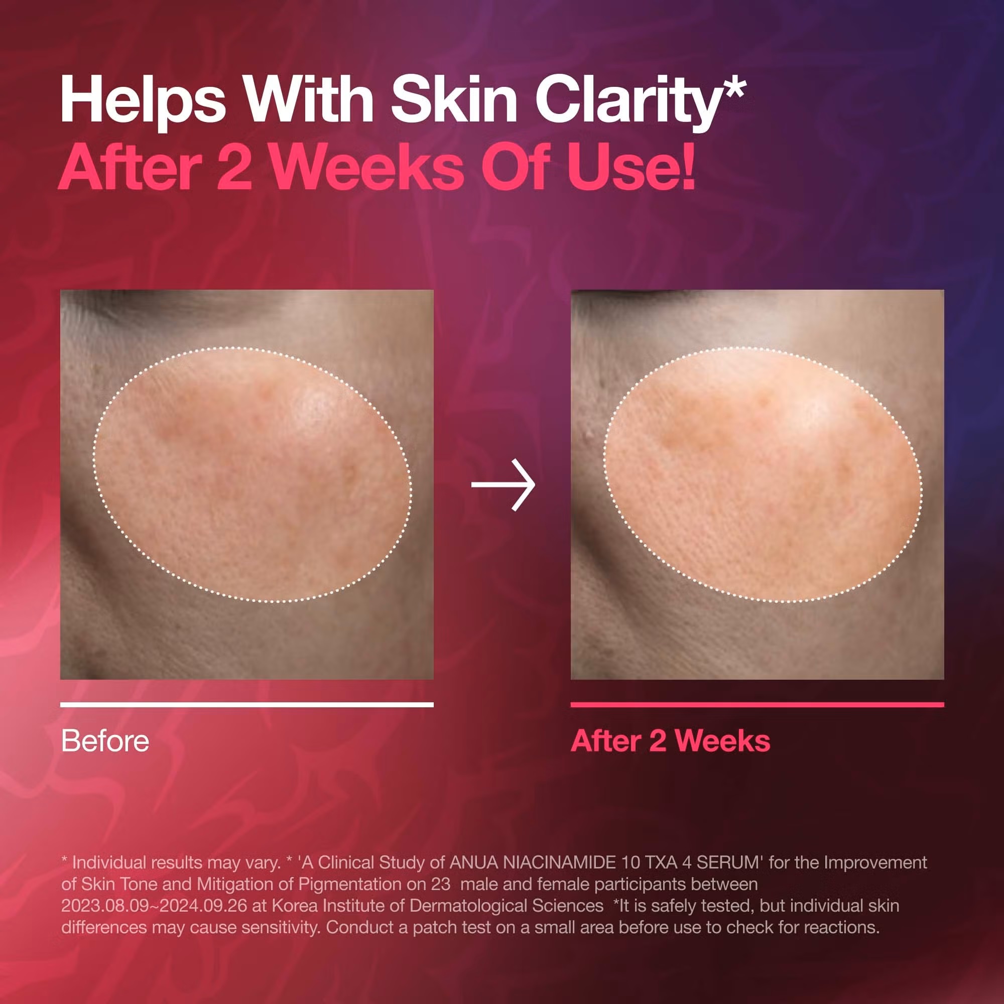 خرید و قیمت سرم ضدلک و روشن‌کننده آنوا Anua مدل Niacinamide 10 + TXA 4 حجم ۵۰ میل