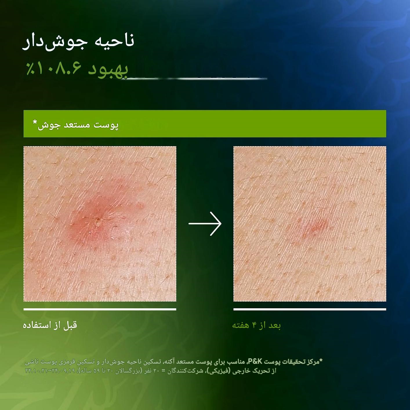 خرید و قیمت سرم تسکین دهنده و آبرسان آنوا Anua حاوی آزلائیک اسید و هیالارون حجم 50 میل