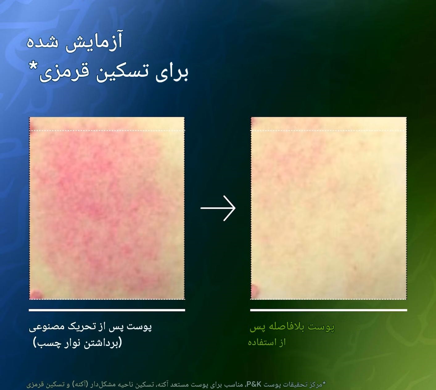 خرید و قیمت سرم تسکین دهنده و آبرسان آنوا Anua حاوی آزلائیک اسید و هیالارون حجم 50 میل